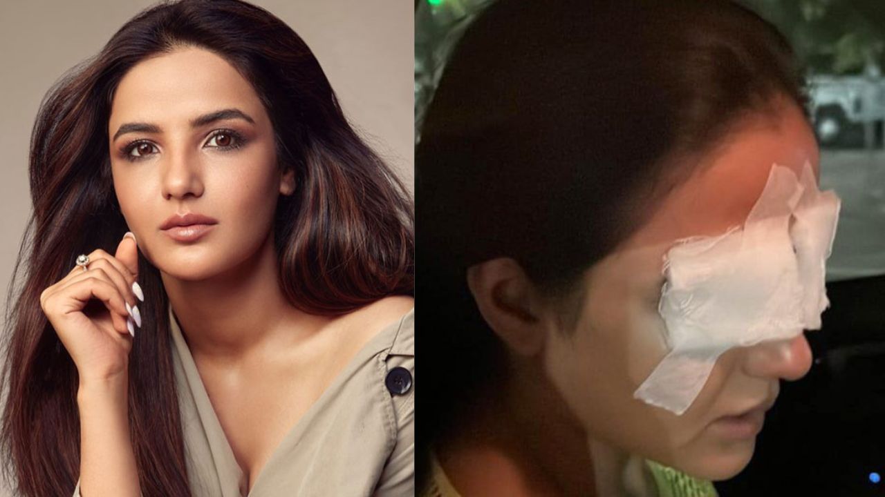 Jasmin Bhasin eye infection